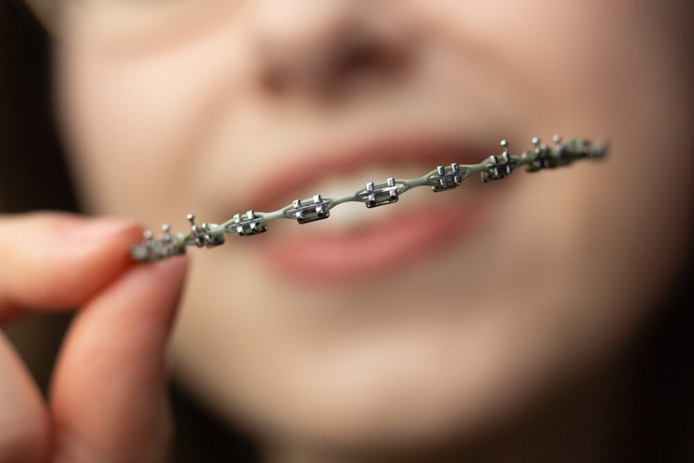 Traditional Braces for Kids Pasco