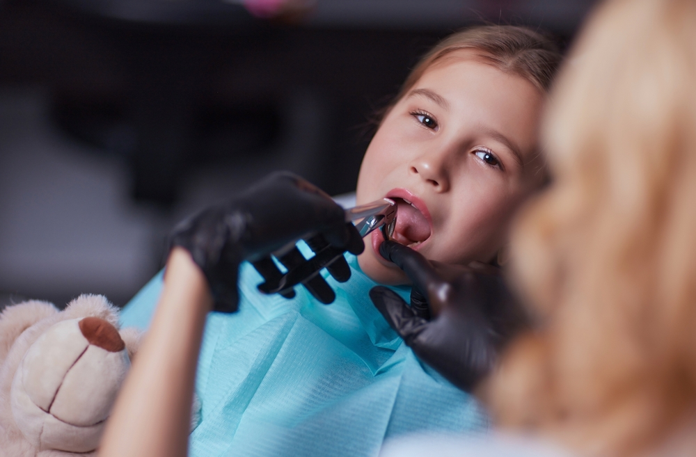 Tooth Extractions for Kids Pasco
